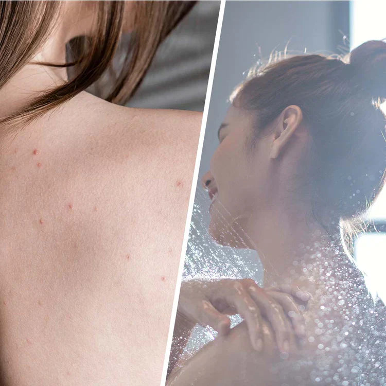 Salicyly Scrub s čajovým stromom na detoxikáciu kože 250 ml