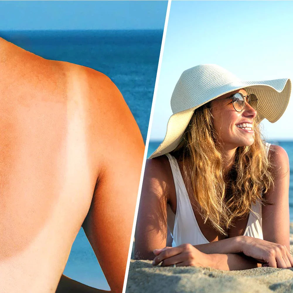 Upokojujúci pleťový sprej s kyselinou hyalurónovou po slnku - 200 ml