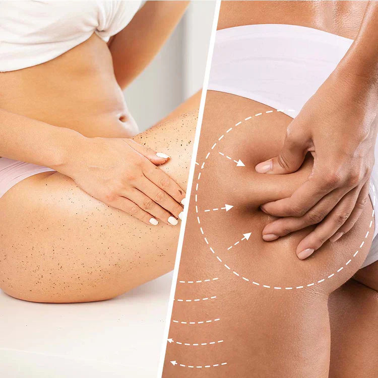 Niacínovo anti-celulitovaný peeling s kokosom na fixovanie a vyhladenie pokožky 250 ml