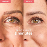 Remescar Instant Wrinkle Corrector - Wrinkle Corrector s okamžitým efektom (180 aplikácií)